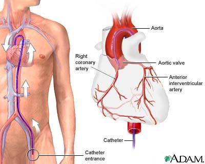 Find Angiography in Pune