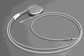 Pacemaker Implantation