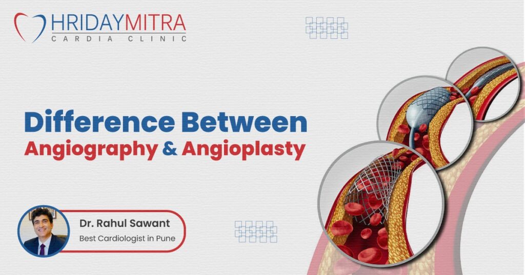 Difference Between Angiography and Angioplasty
