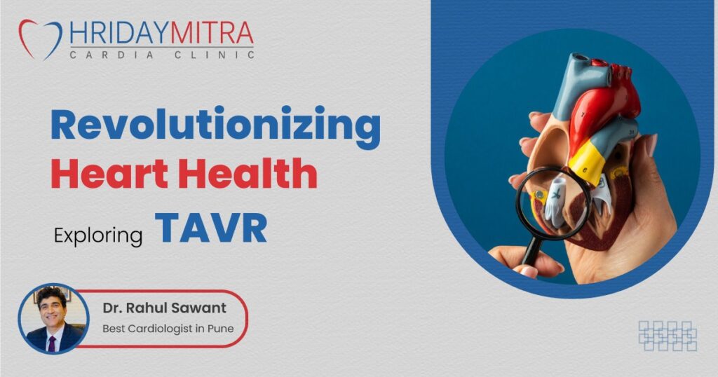 Exploring Transcatheter Aortic Valve Replacement