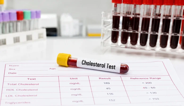 The Role of Cholesterol Screening in Preventing He art Disease